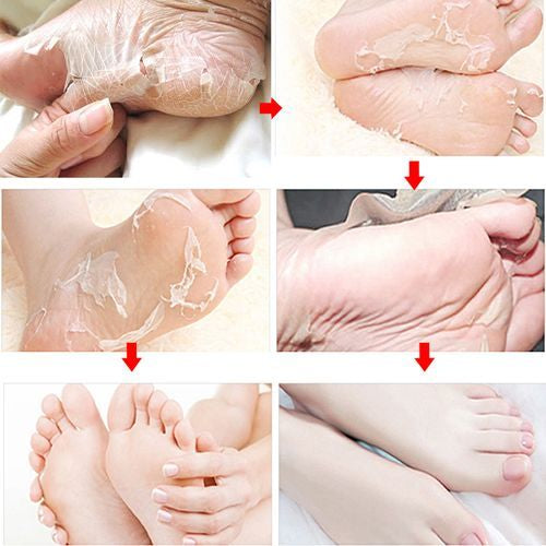 FOOT CARE - Exfoliating Socks - Paire Chaussettes Exfoliante Soin Anti Callosité